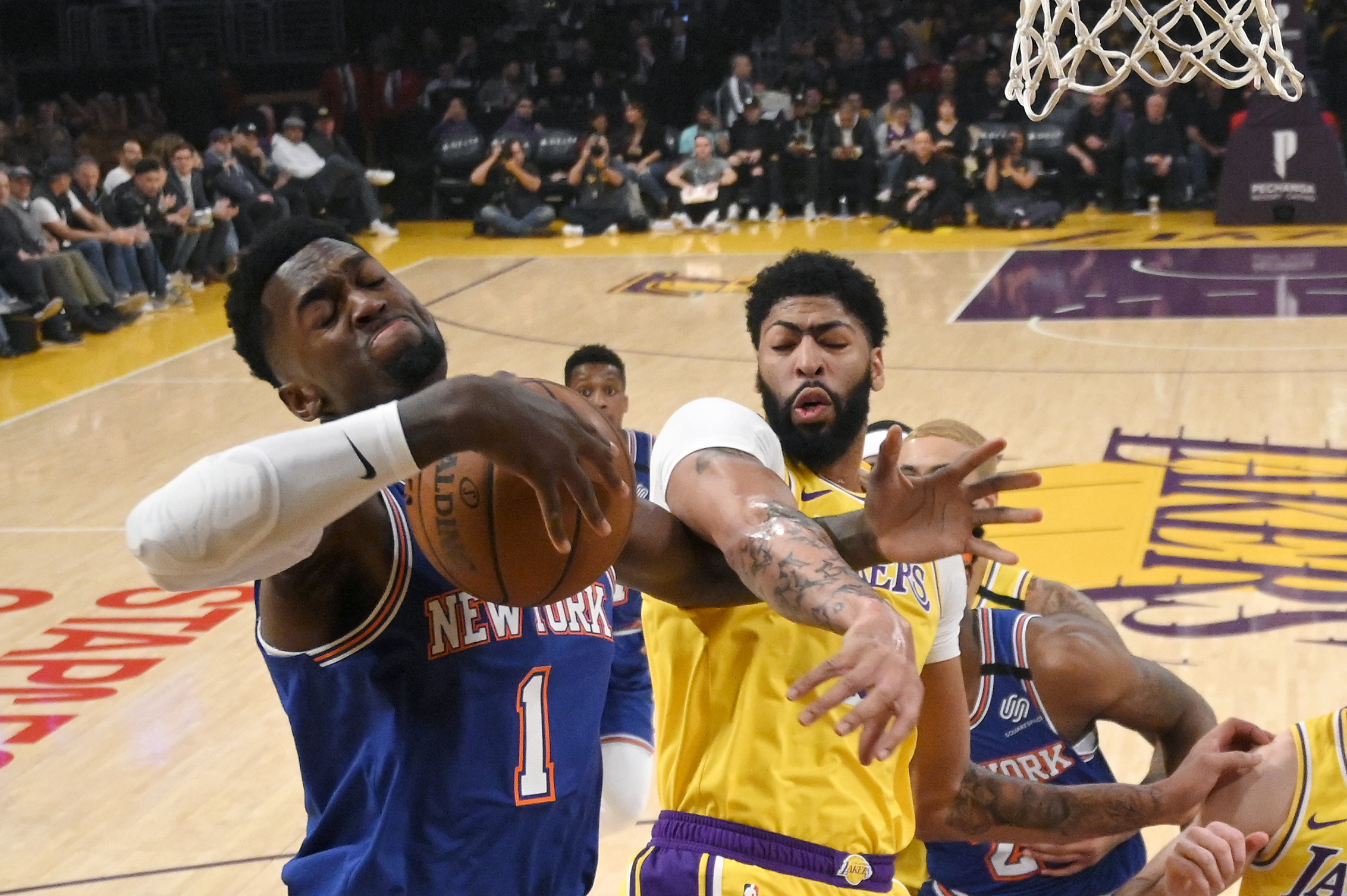 Anthony Davis bruises back in Lakers' 117-87 win over Knicks