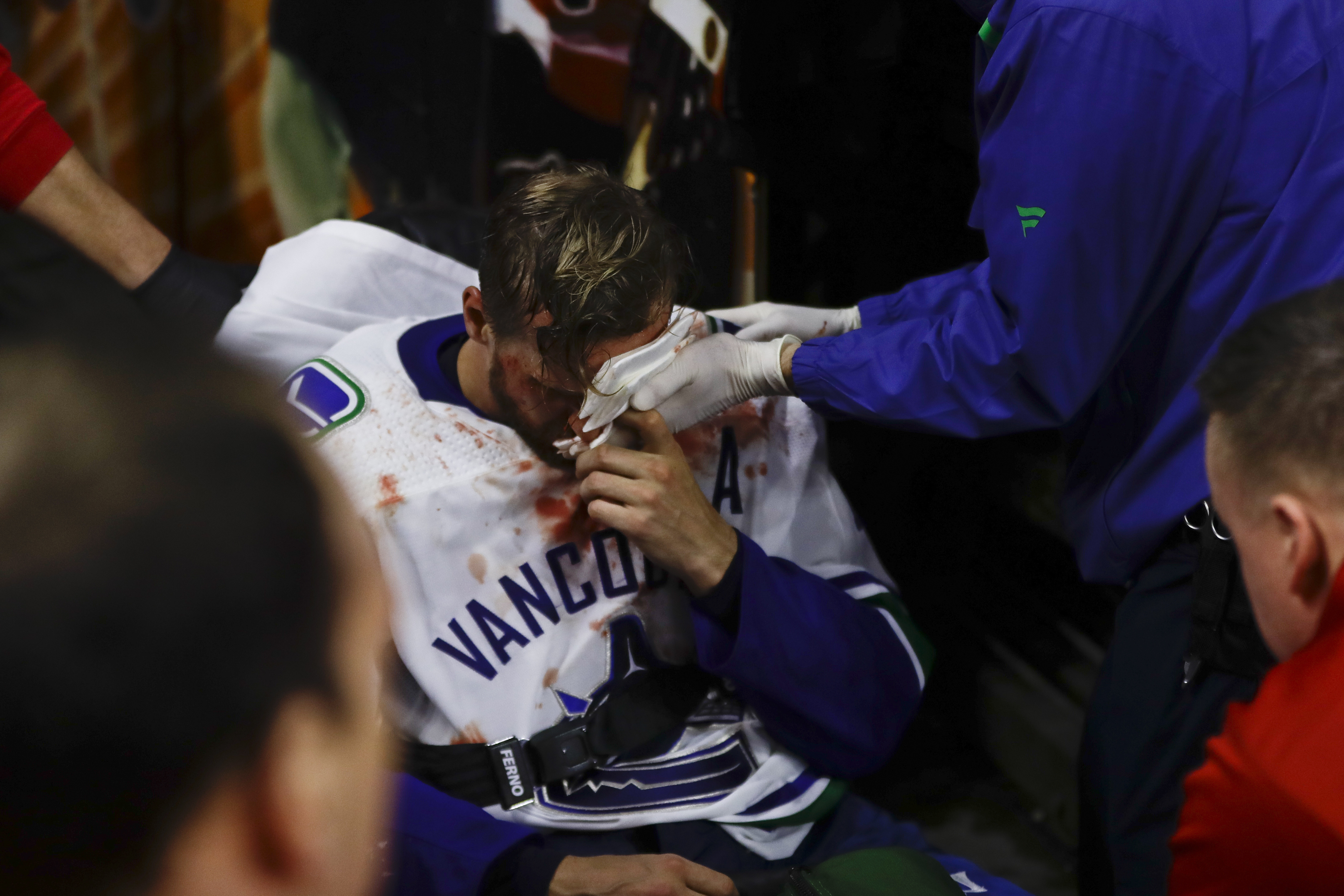 Canucks' Edler bloodied, carted off after face-first fall