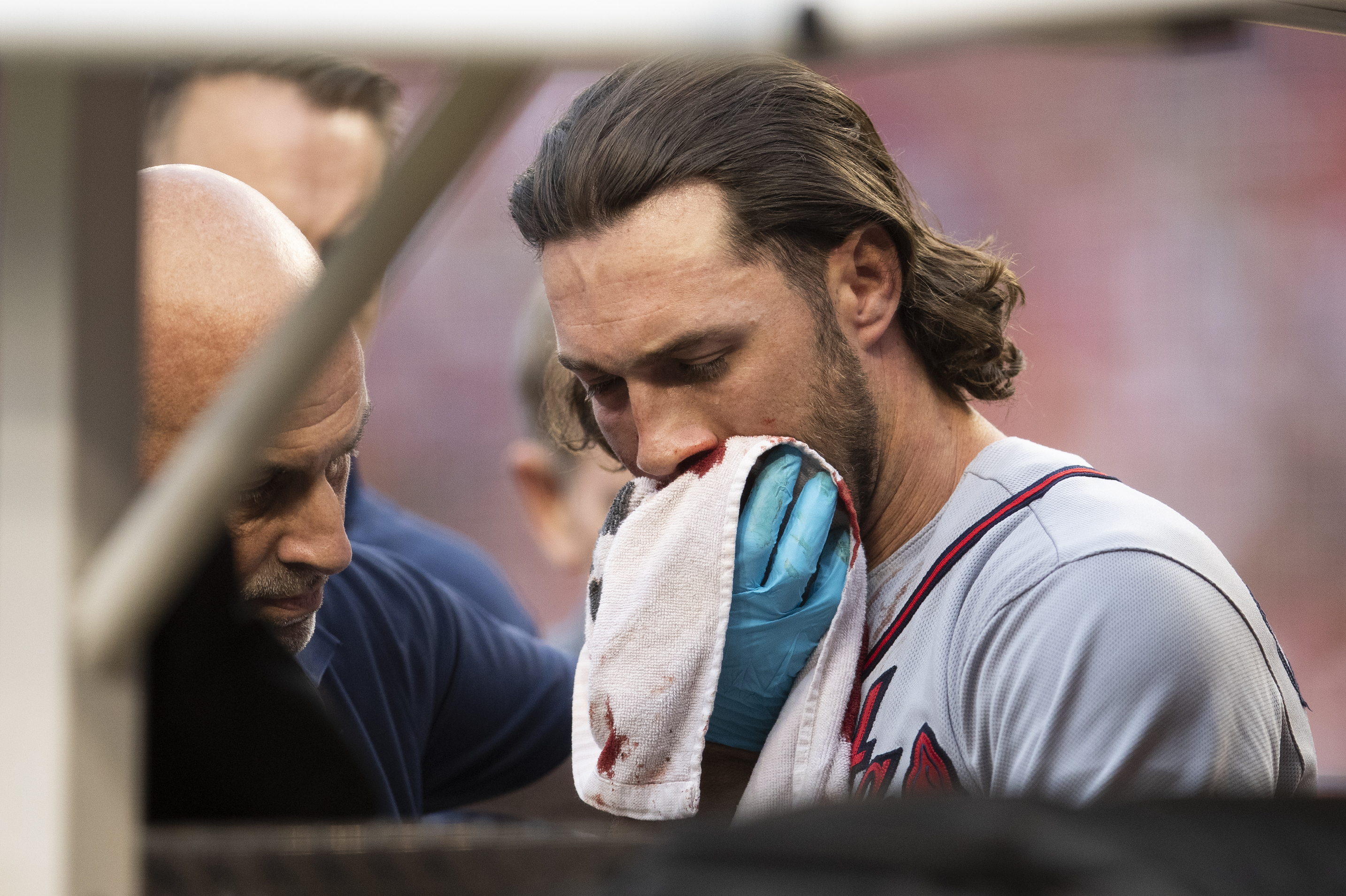 Braves' Culberson has multiple facial fractures