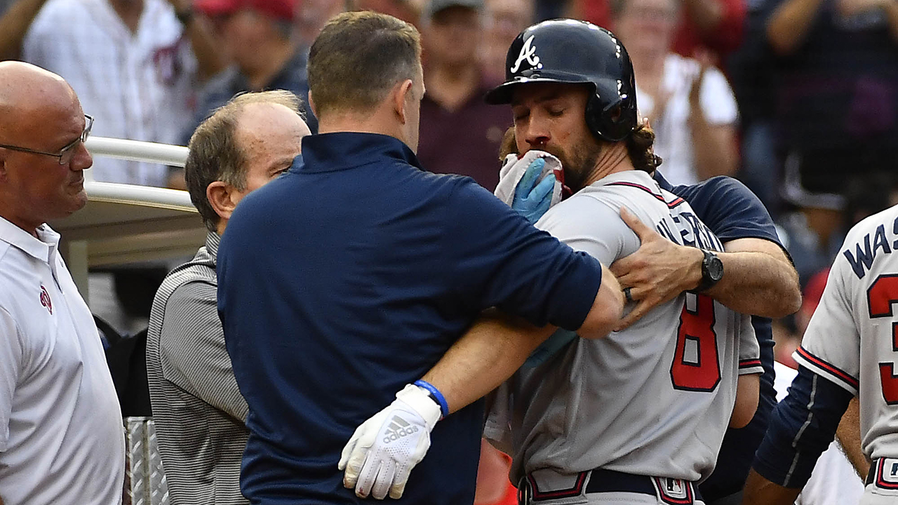 Three Cuts: Losing Charlie Culberson major blow to Braves' depth on postseason roster